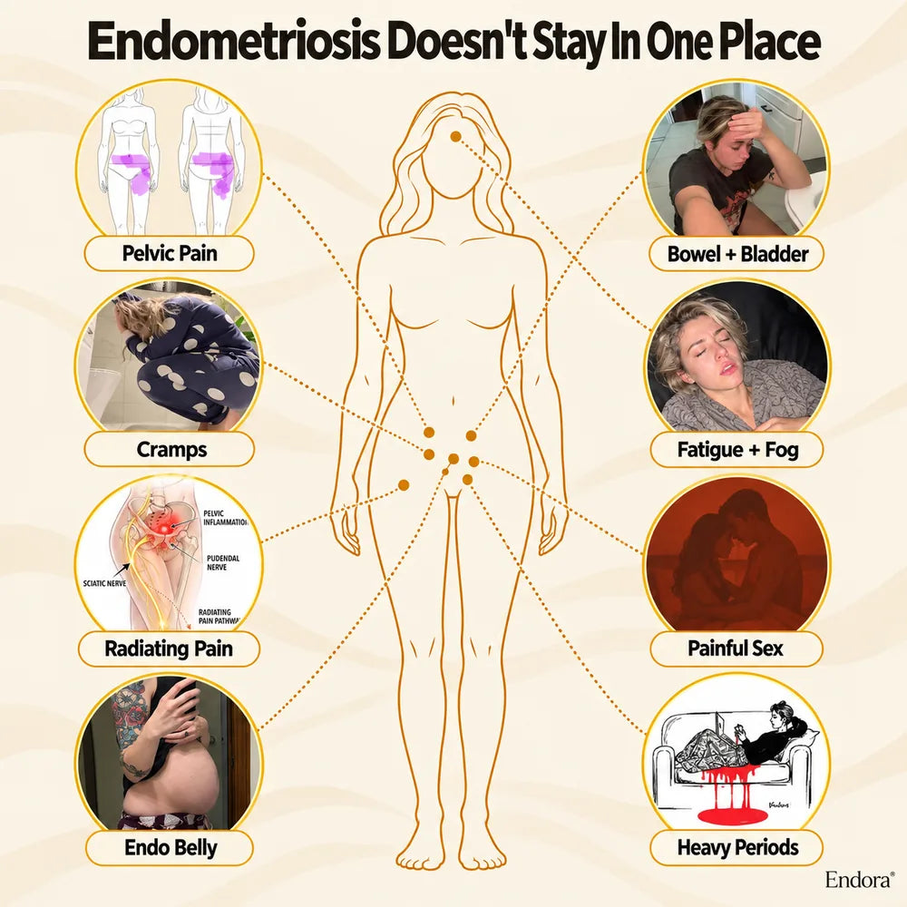 Endora From Endo Warriors to Endo Warriors..p2